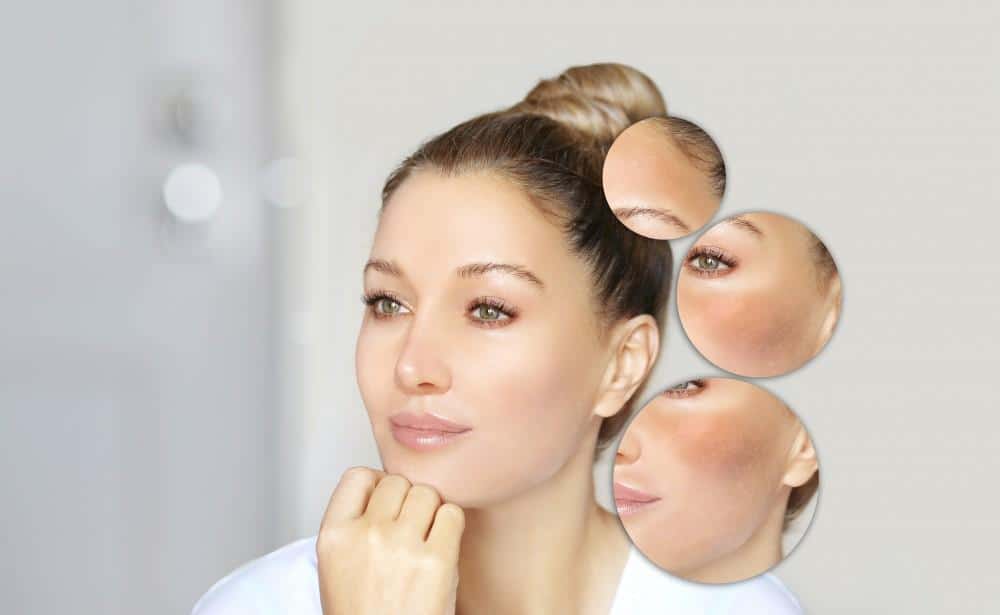 How Is Fraxel® Different from Other Types of Lasers?