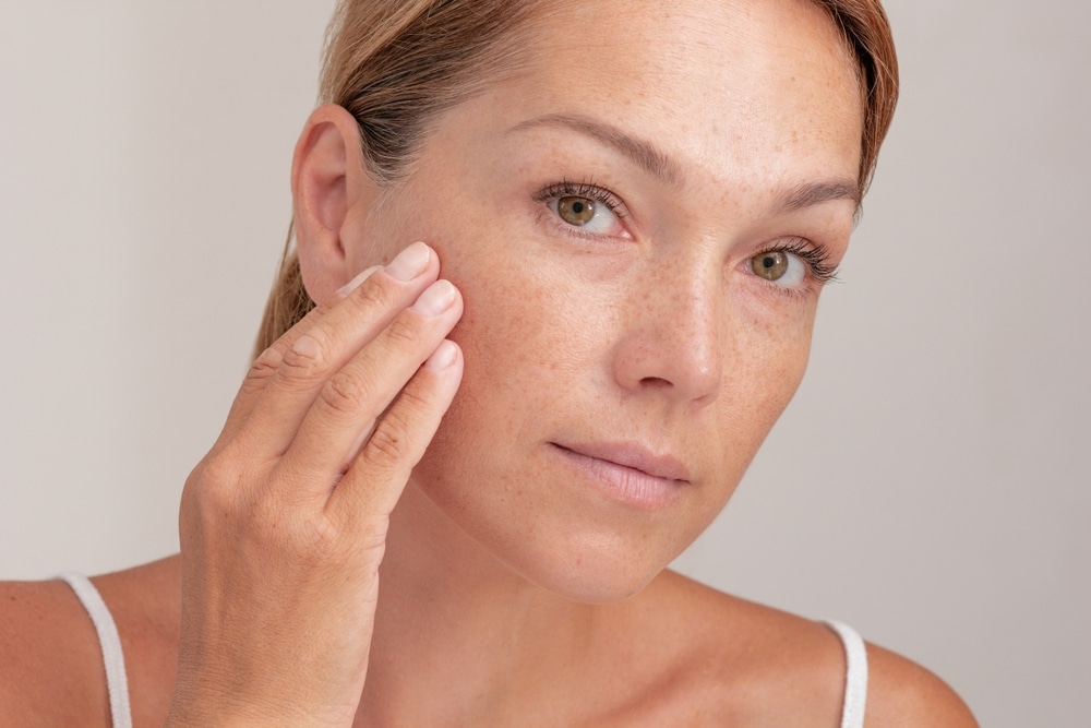 Woman touching cheek with visible sun spots and uneven pigmentation.